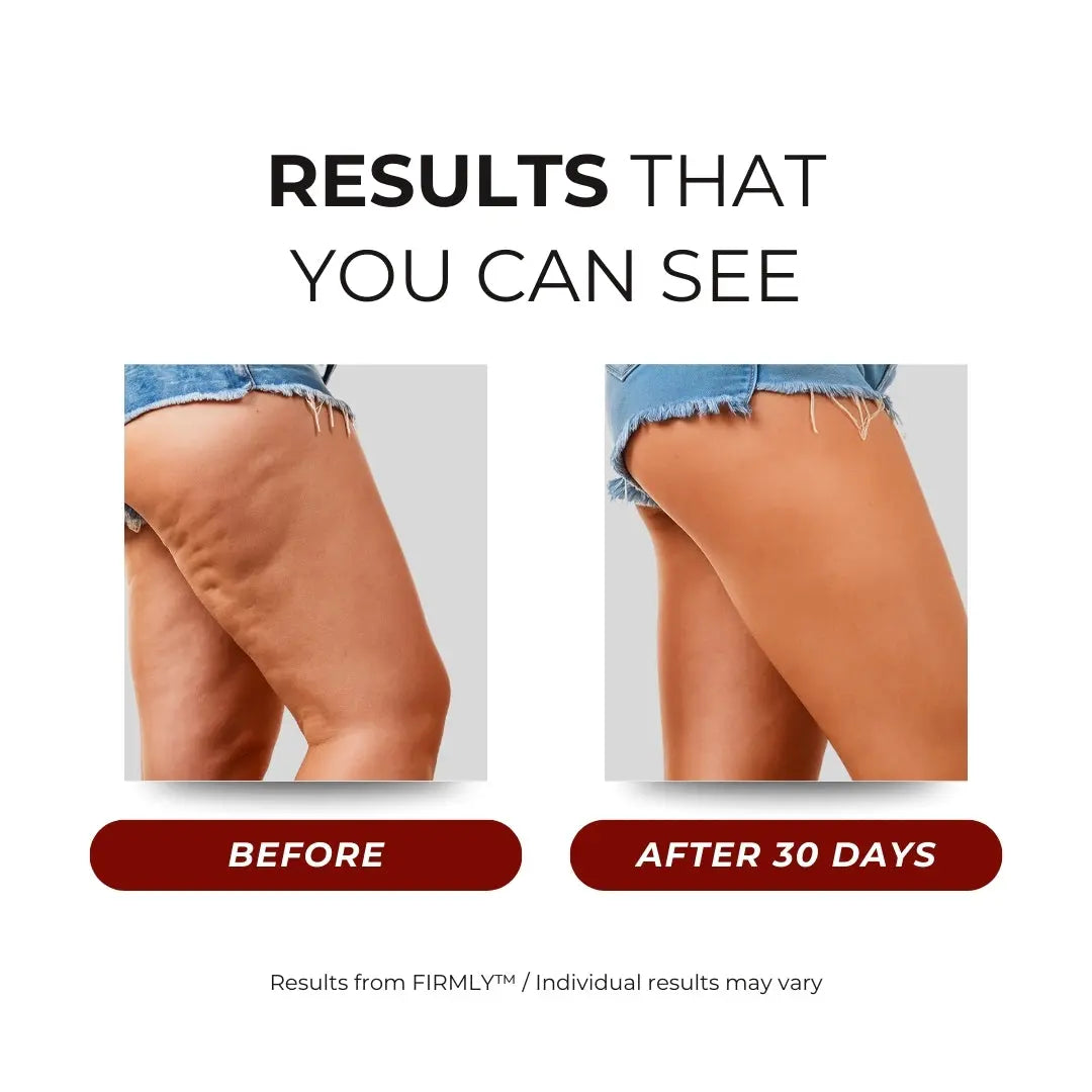 FIRMLY™ LEGS | Dual-Wavelength Red Light Panels with 3-Layer Lift Technology™