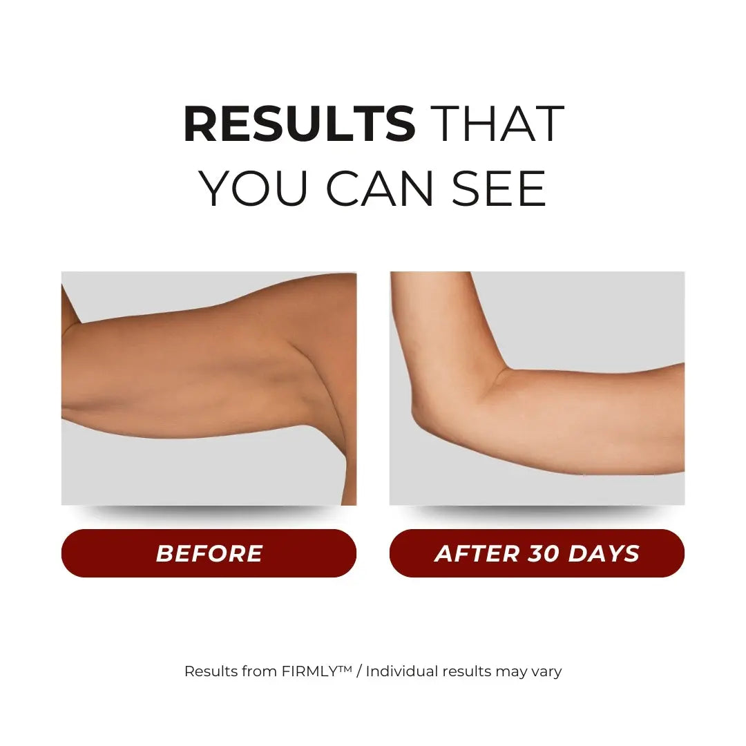 FIRMLY™ ARM | Dual-Wavelength Red Light Wrap with 3-Layer Lift Technology™
