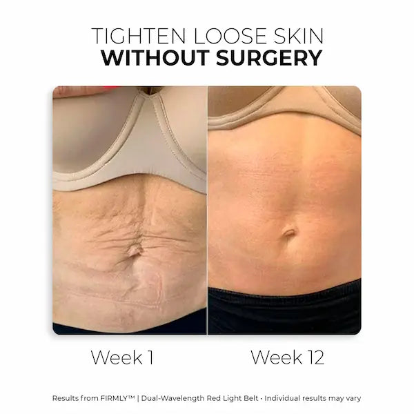 FIRMLY™ | Dual-Wavelength Red Light Belt with 3-Layer Lift Technology™